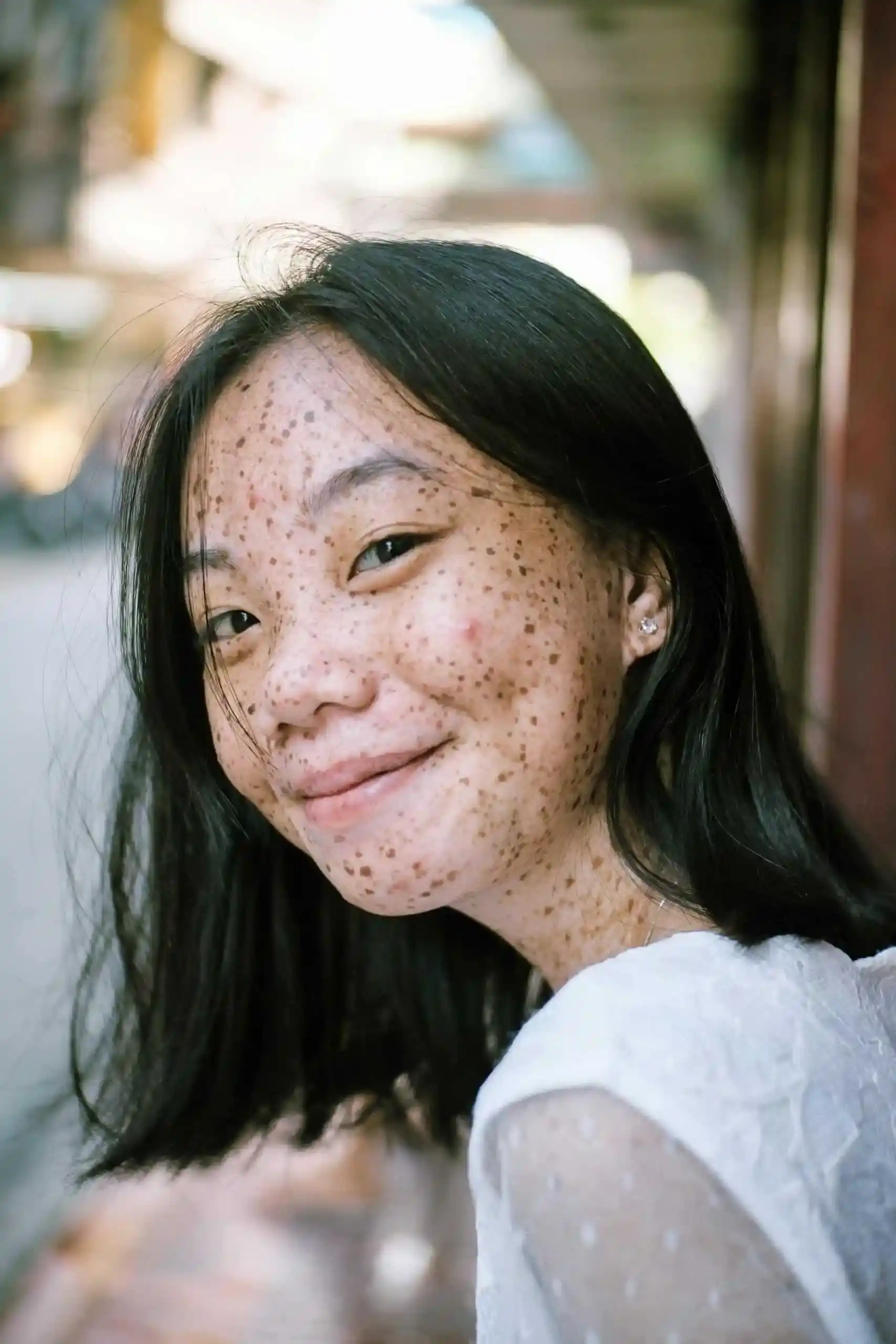 2709388 (1) Close-up portrait of a smiling young woman with freckles, capturing a natural and joyful expression outdoors.